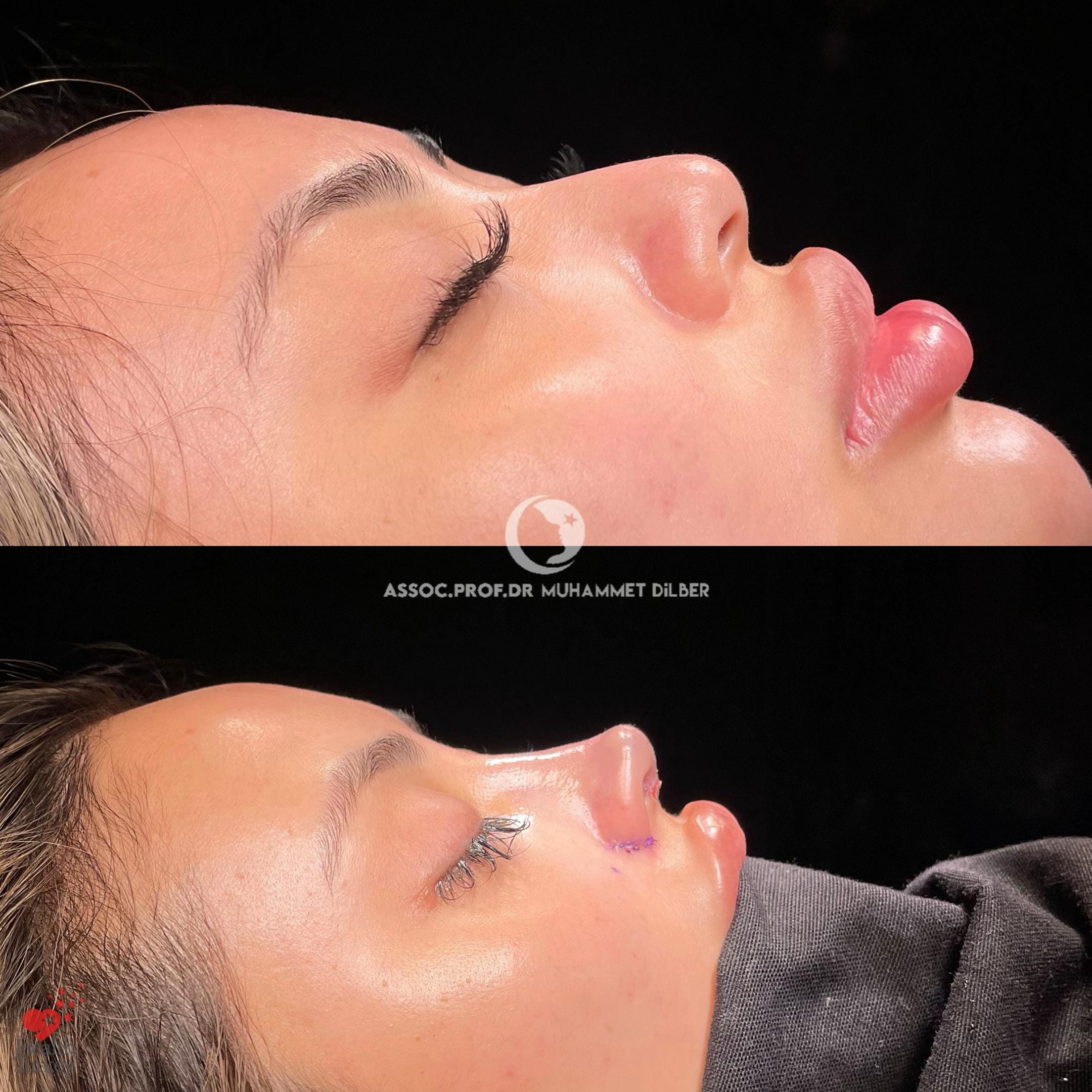 Post 2 by dr.muhammet.dilber on TikTok (video)