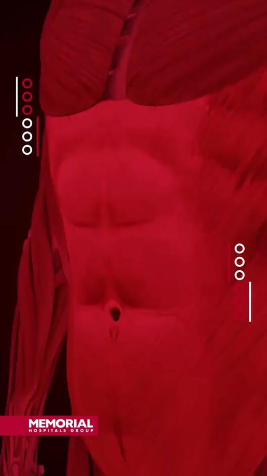 Post 10 by Memorial Hospital Arabica on TikTok (video)