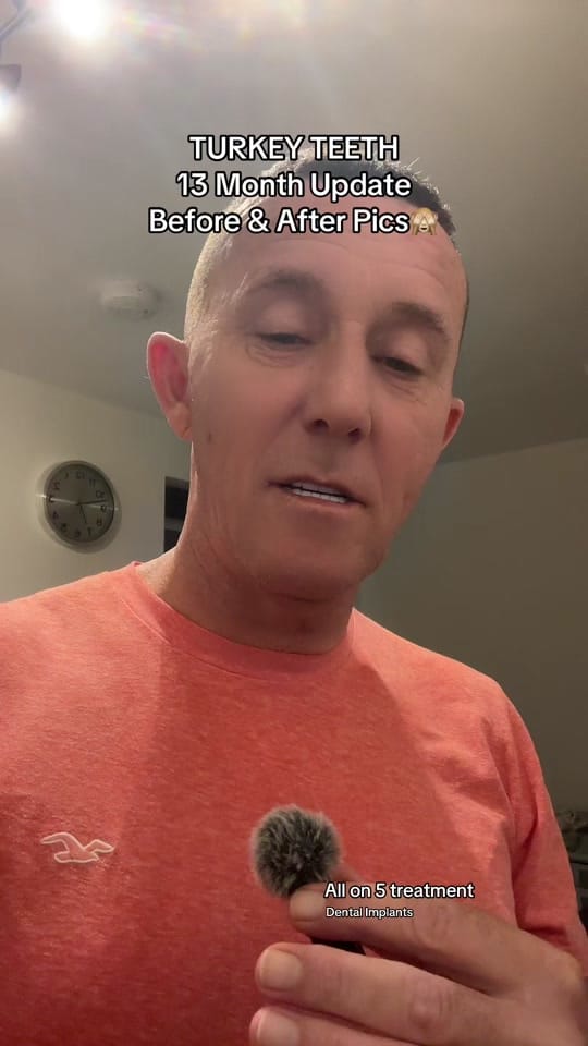 Post 8 by stevesturkeyteethjourney on TikTok (video)