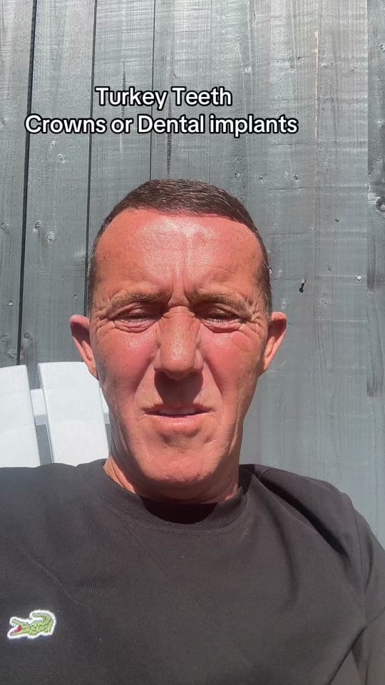 Post 5 by stevesturkeyteethjourney on TikTok (video)