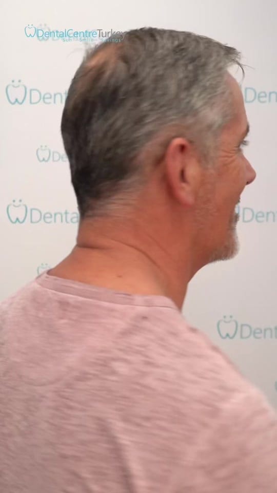 Post 2 by dentalcentreturkey on TikTok (video)