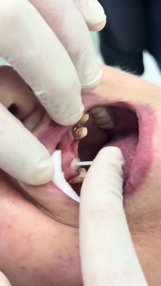 Post 6 by Dr.Haşim Yasin on TikTok (video)