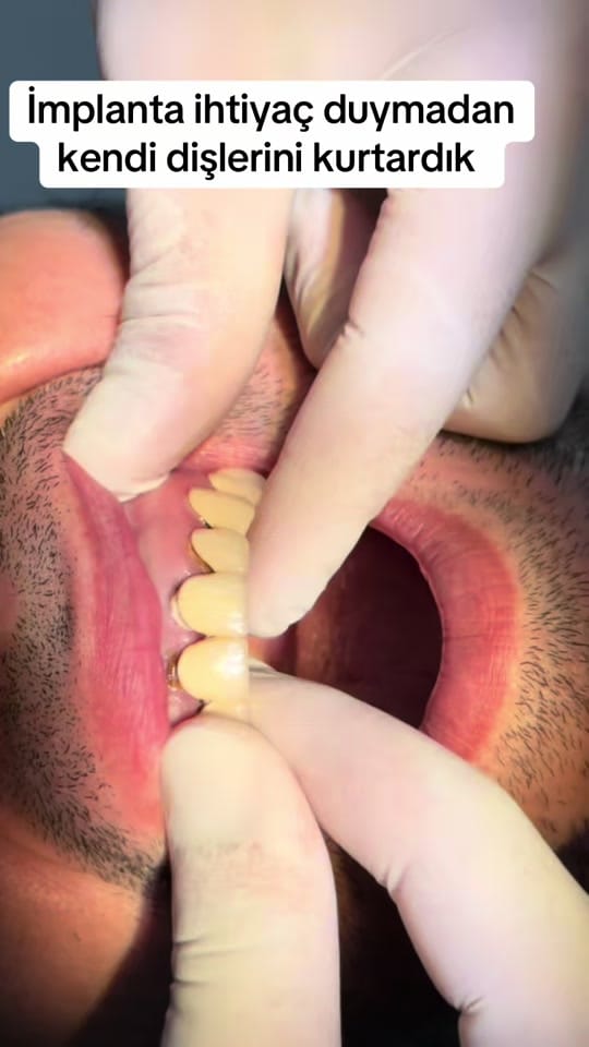 Post 5 by Dr.Haşim Yasin on TikTok (video)