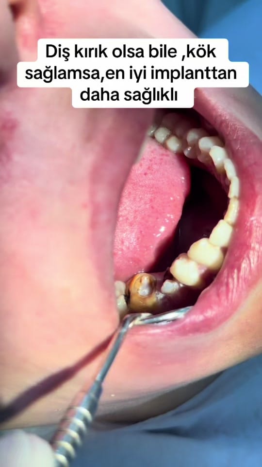 Post 4 by Dr.Haşim Yasin on TikTok (video)
