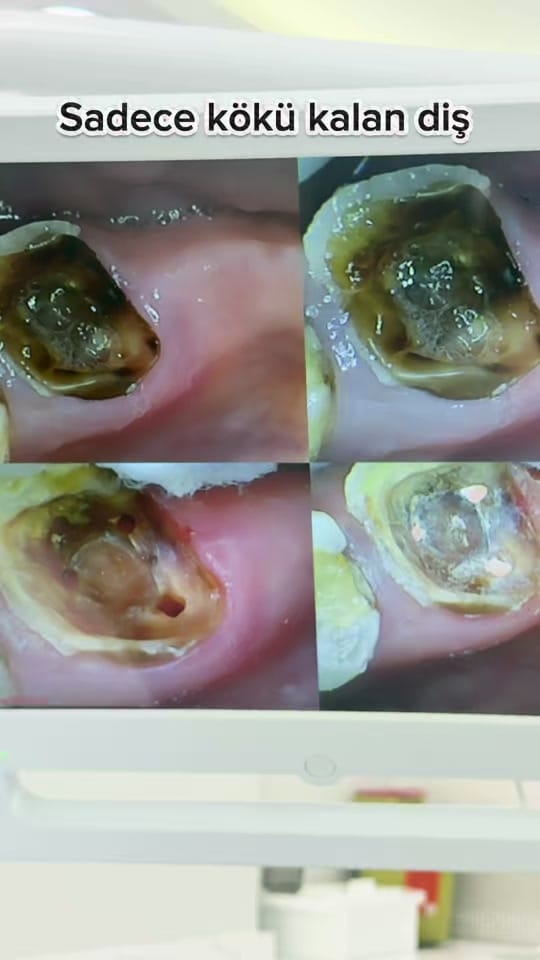 Post 1 by Dr.Haşim Yasin on TikTok (video)