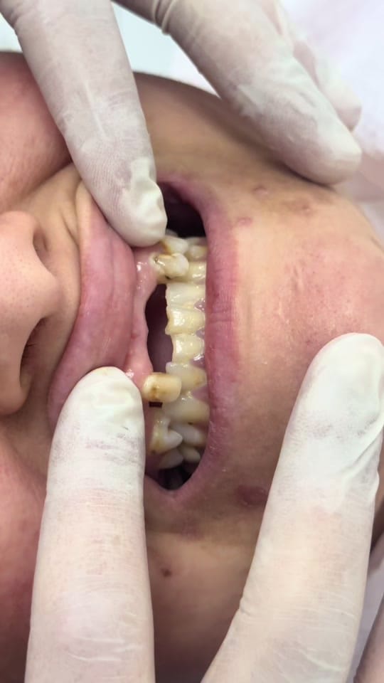 Post 2 by Dr.Haşim Yasin on TikTok (video)