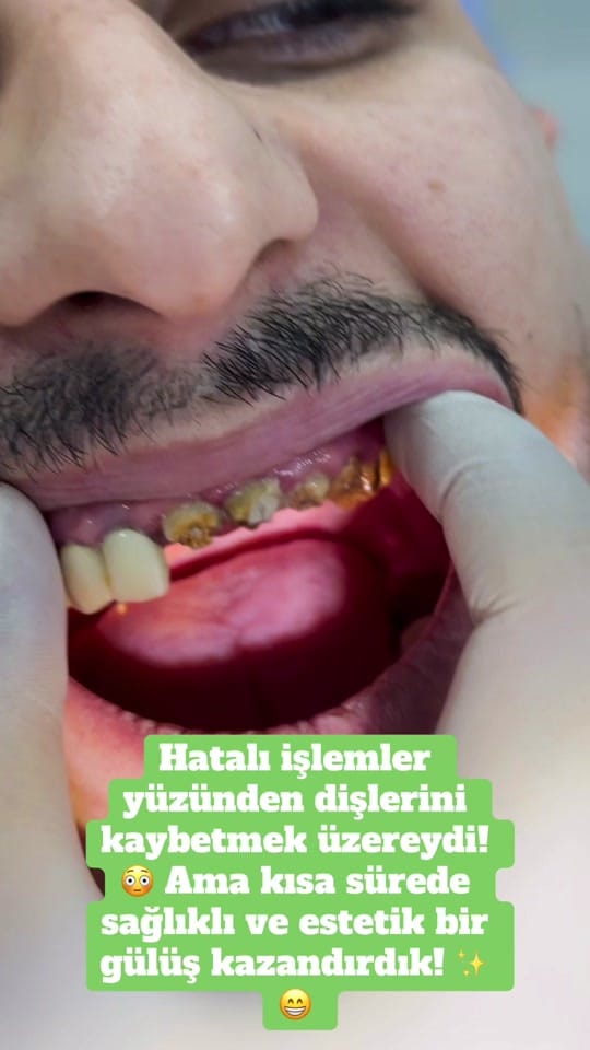 Post 10 by Dr.Haşim Yasin on TikTok (video)