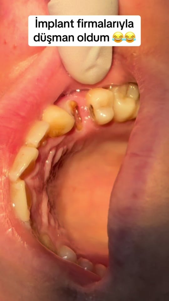 Post 7 by Dr.Haşim Yasin on TikTok (video)