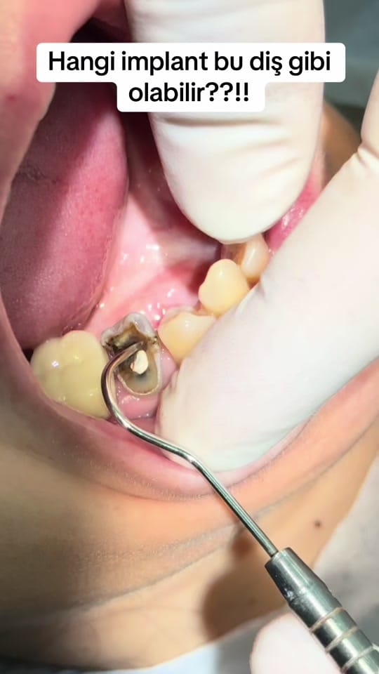 Post 3 by Dr.Haşim Yasin on TikTok (video)