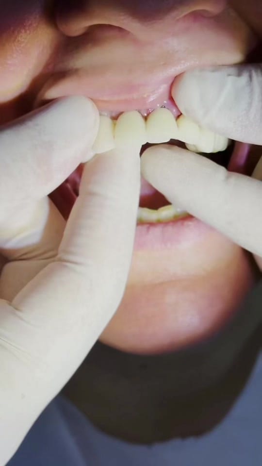 Post 9 by Dr.Haşim Yasin on TikTok (video)
