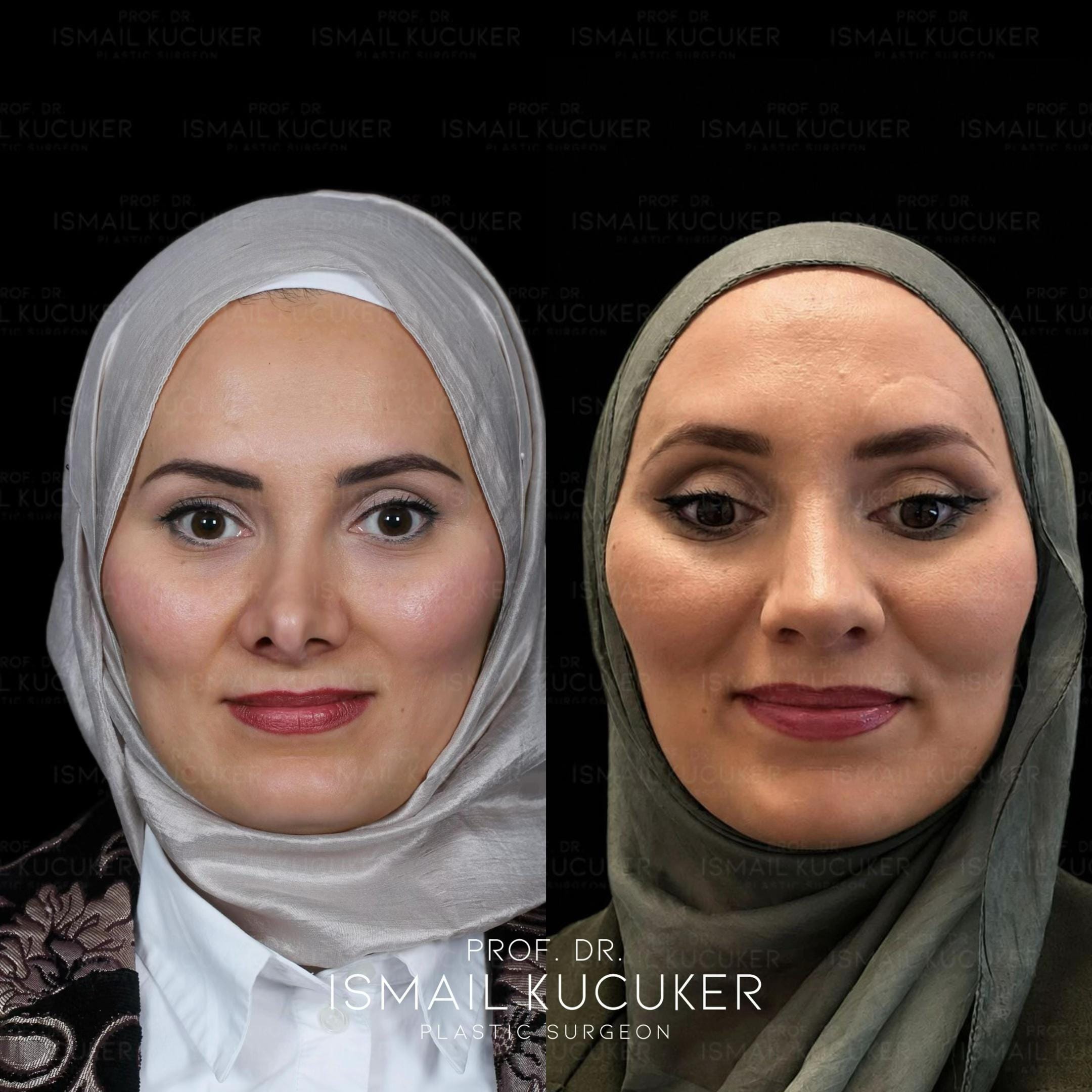 Post 5 by Prof. Dr. İsmail Küçüker on TikTok (video)