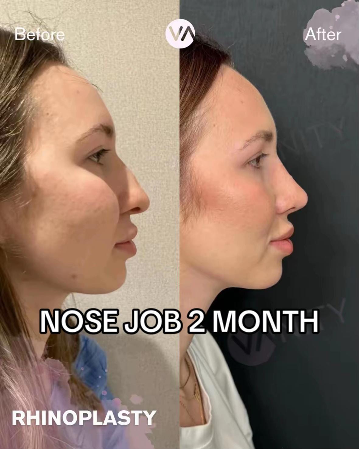 Post 1 by Vanity Clinic on TikTok (video)