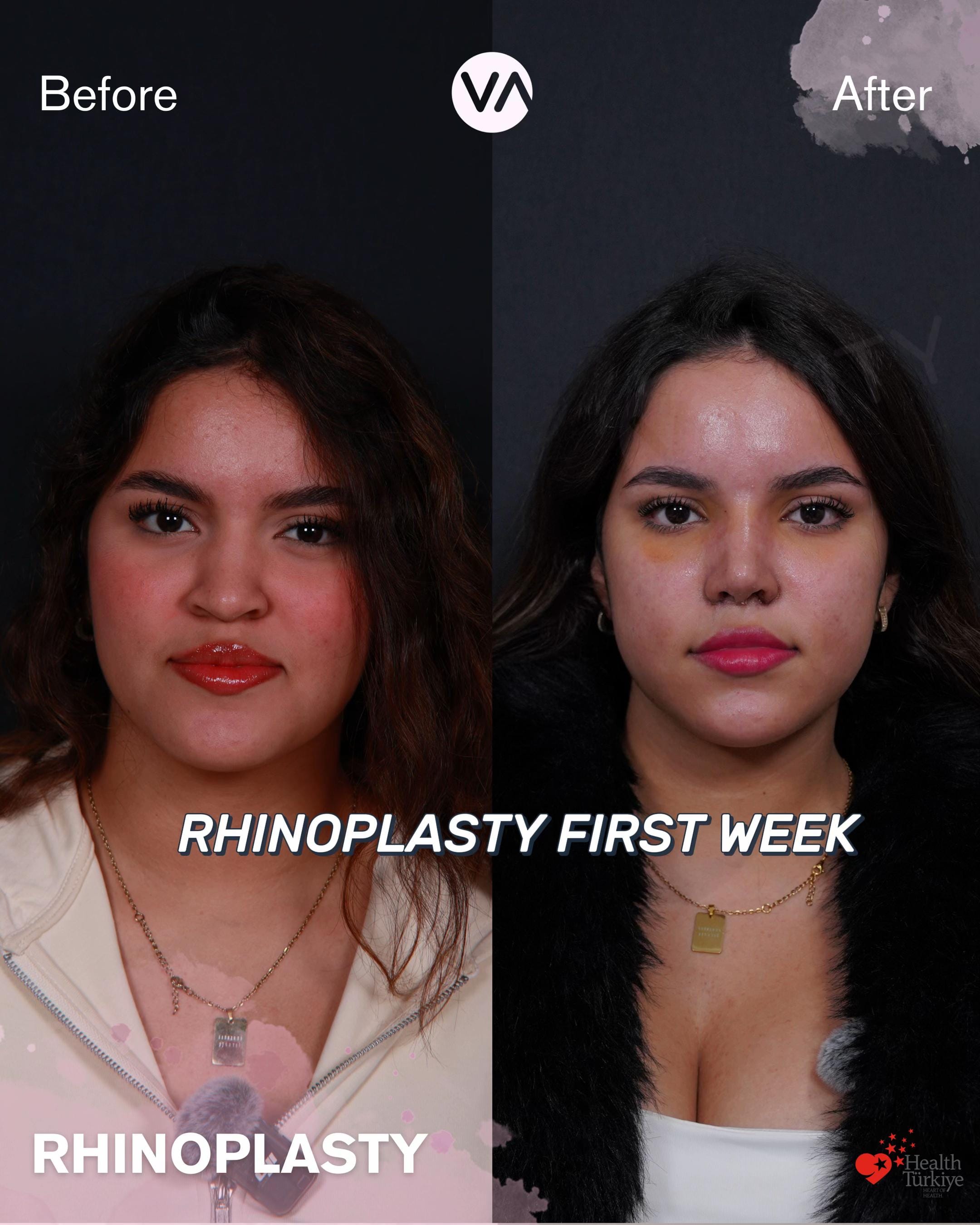 Post 8 by Vanity Clinic on TikTok (video)