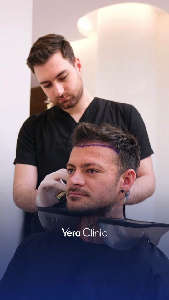 Post 5 by VeraClinic|HairTransplant 🇹🇷 on TikTok (video)