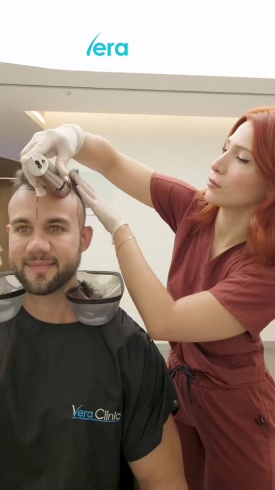 Post 9 by VeraClinic|HairTransplant 🇹🇷 on TikTok (video)