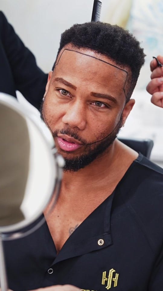 Post 8 by Sule Hair Transplant on TikTok (video)