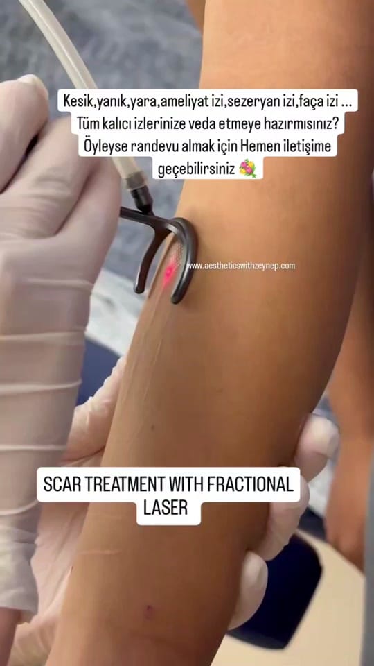 Post 10 by İstanbul Aesthetics on TikTok (video)