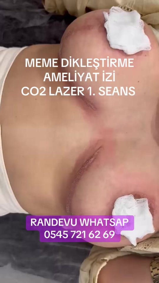 Post 7 by İstanbul Aesthetics on TikTok (video)