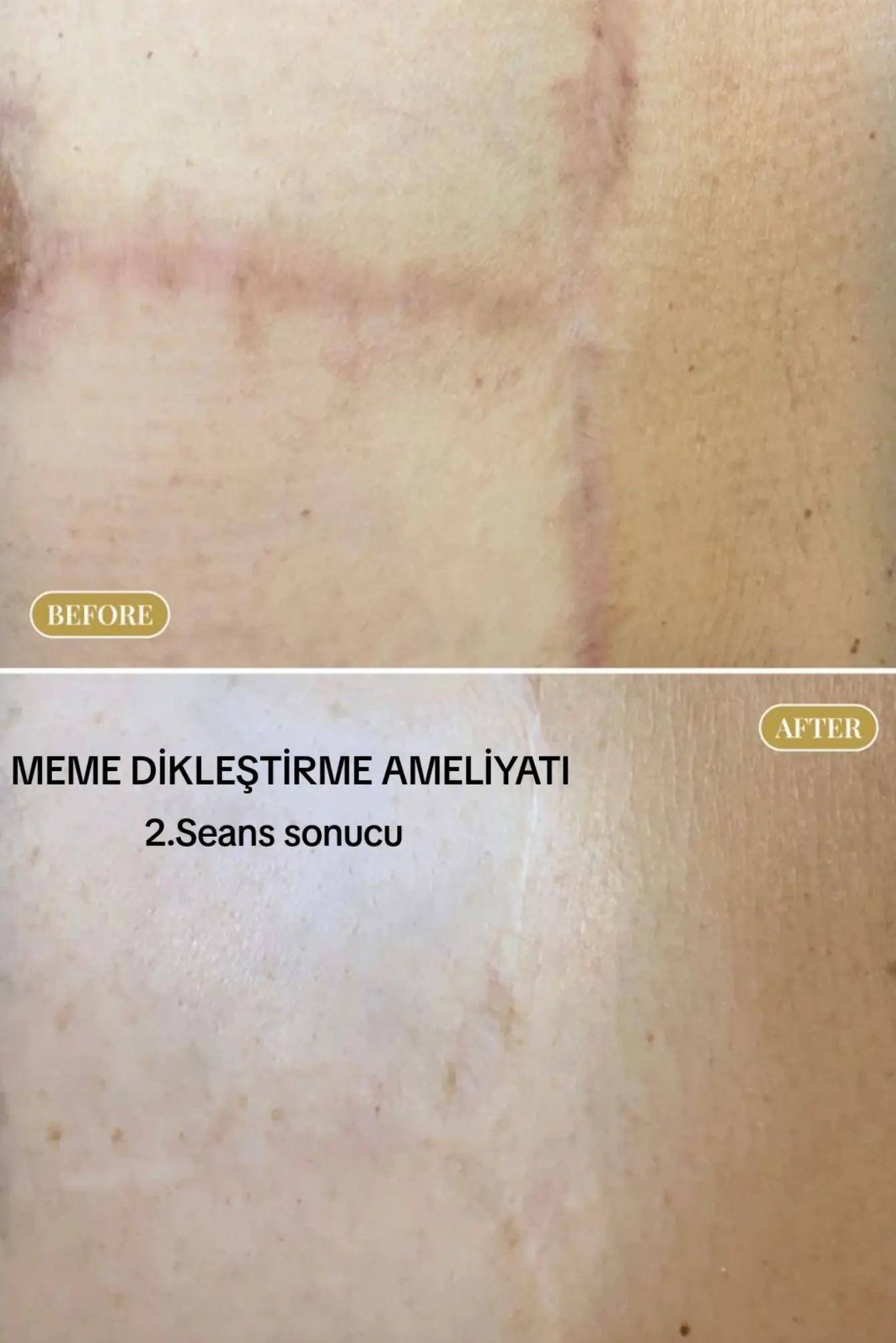 Post 6 by İstanbul Aesthetics on TikTok (video)
