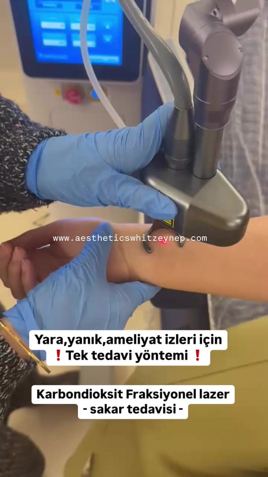 Post 9 by İstanbul Aesthetics on TikTok (video)