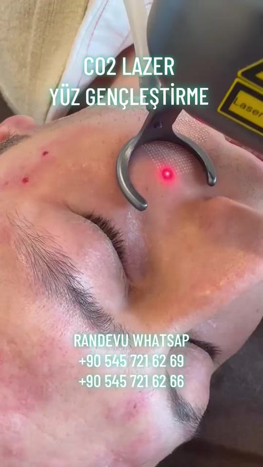 Post 4 by İstanbul Aesthetics on TikTok (video)