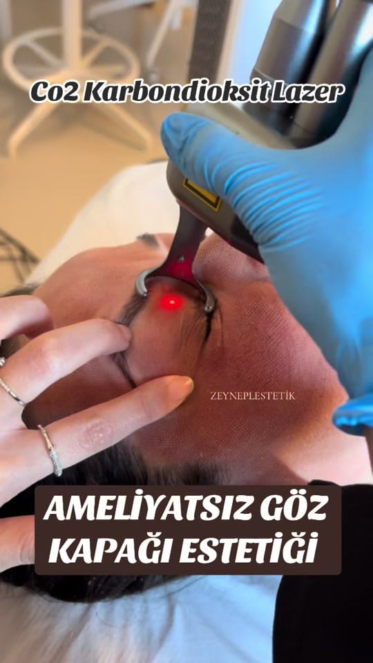 Post 8 by İstanbul Aesthetics on TikTok (video)