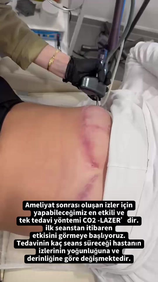 Post 1 by İstanbul Aesthetics on TikTok (video)