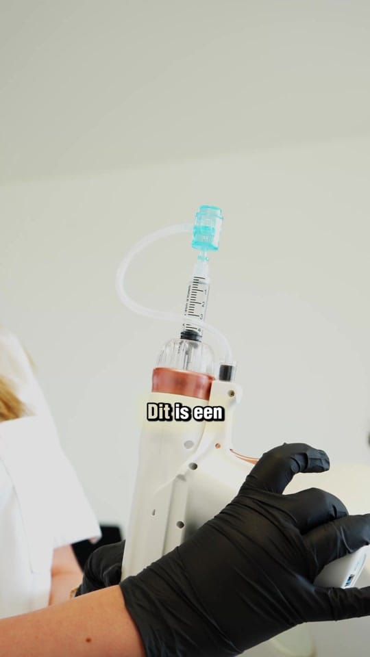 Post 3 by Clinic Mesohair on TikTok (video)