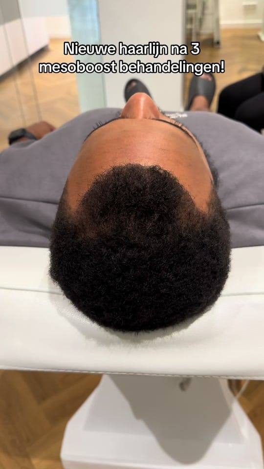 Post 4 by Clinic Mesohair on TikTok (video)