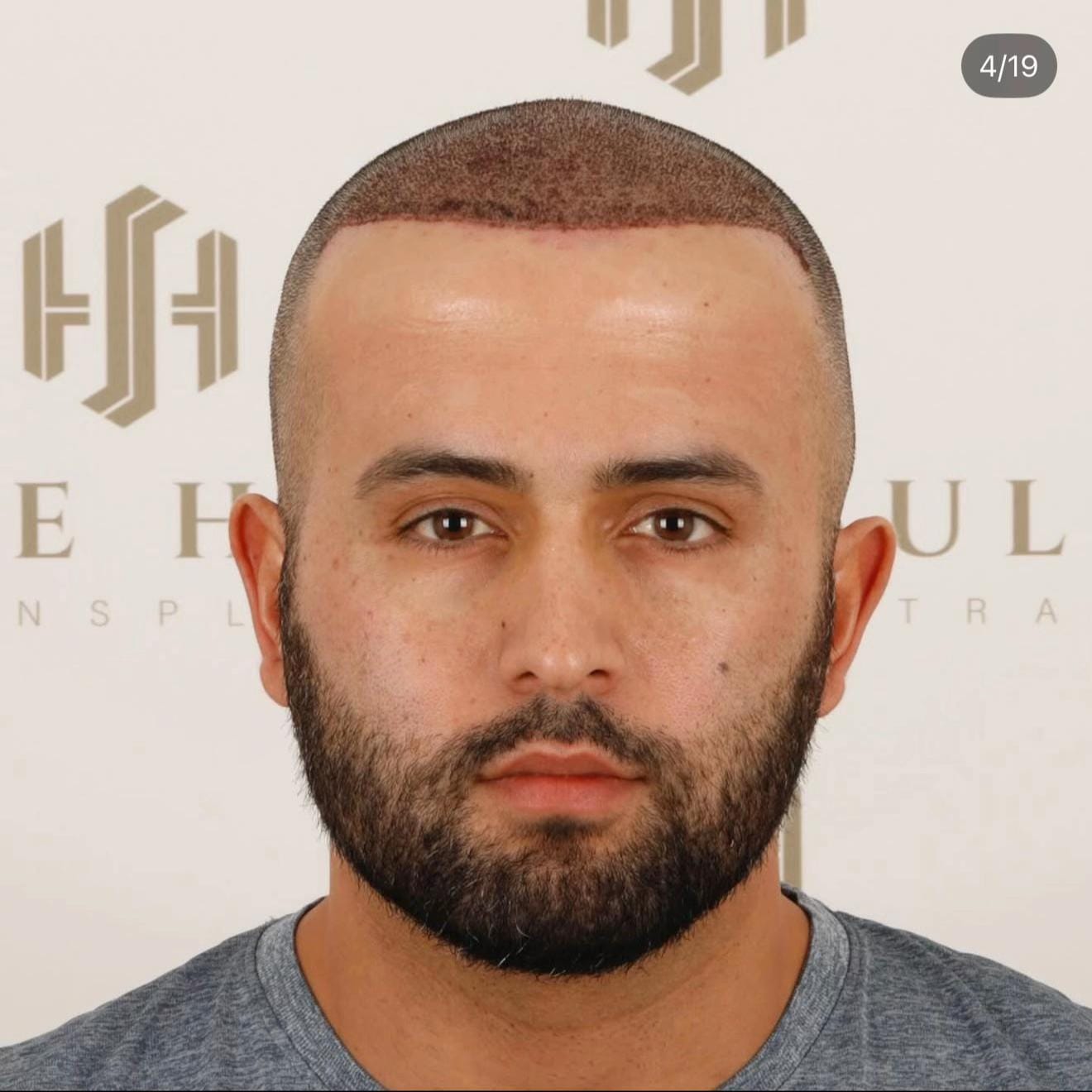 Post 9 by Clinic Mesohair on TikTok (video)