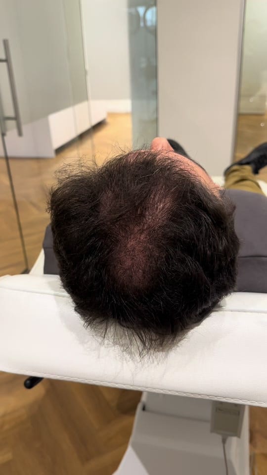 Post 6 by Clinic Mesohair on TikTok (video)