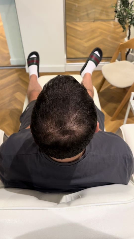 Post 10 by Clinic Mesohair on TikTok (video)