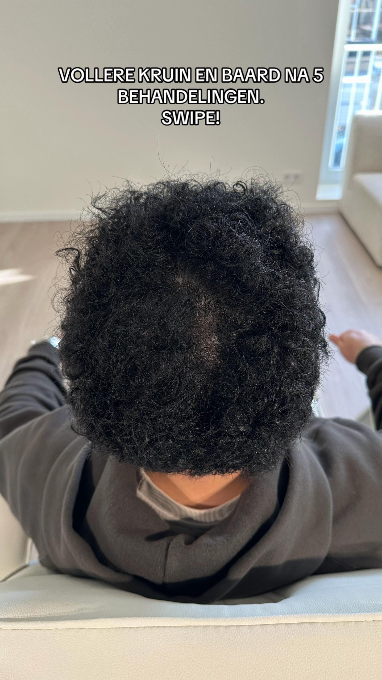 Post 7 by Clinic Mesohair on TikTok (video)