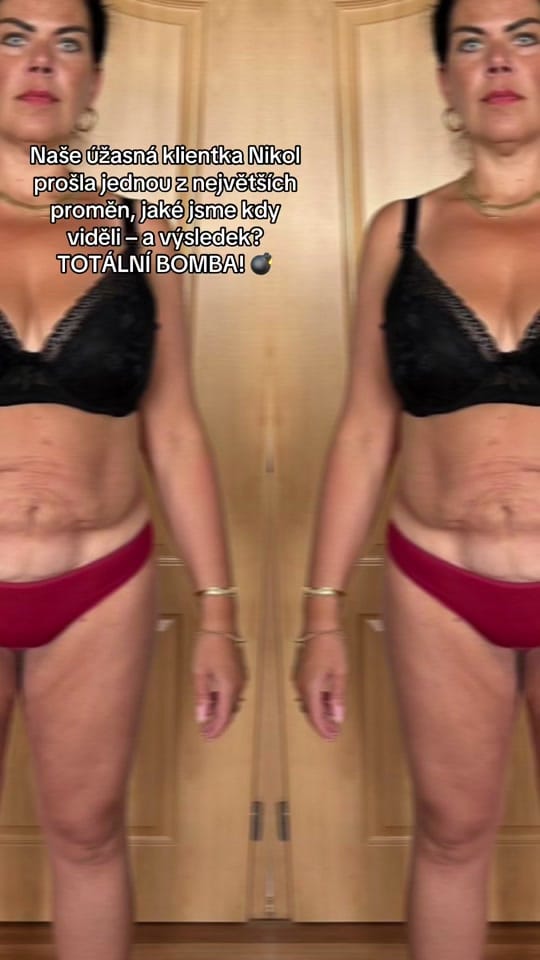 Post 3 by clinic14cesko on TikTok (video)