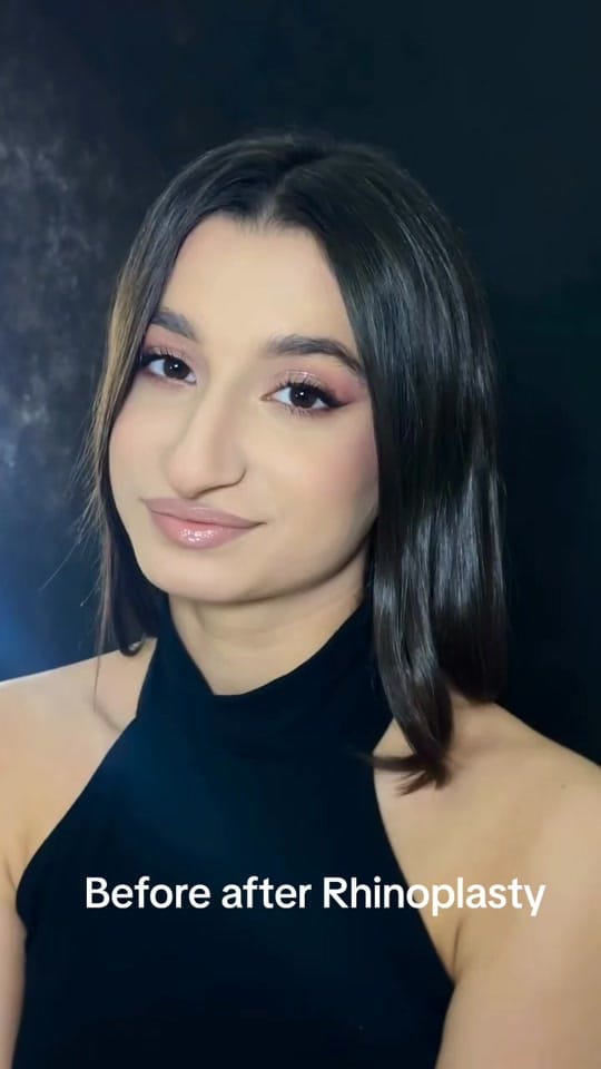 Post 6 by Plastic surgery in Turkey🇹🇷 on TikTok (video)