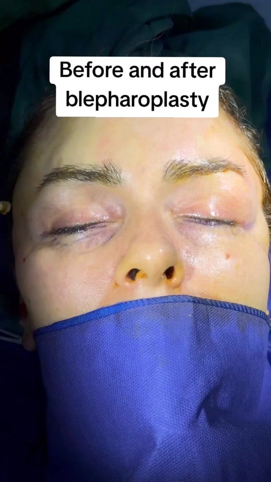 Post 4 by Plastic surgery in Turkey🇹🇷 on TikTok (video)