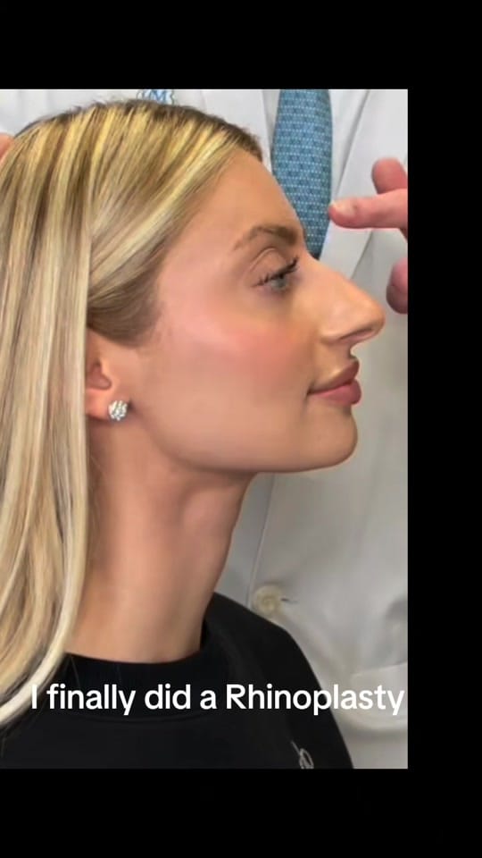 Post 1 by Plastic surgery in Turkey🇹🇷 on TikTok (video)