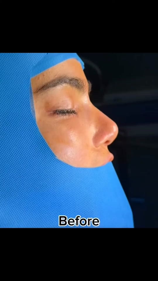 Post 3 by Plastic surgery in Turkey🇹🇷 on TikTok (video)
