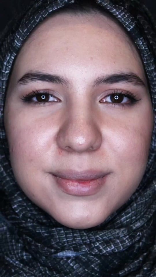 Post 5 by Plastic surgery in Turkey🇹🇷 on TikTok (video)