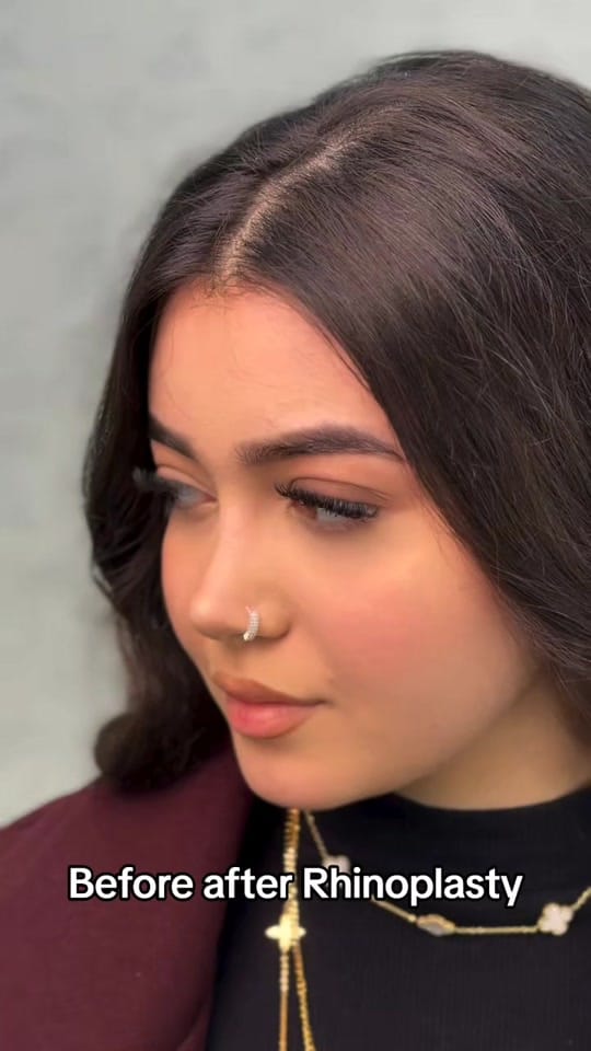 Post 9 by Plastic surgery in Turkey🇹🇷 on TikTok (video)