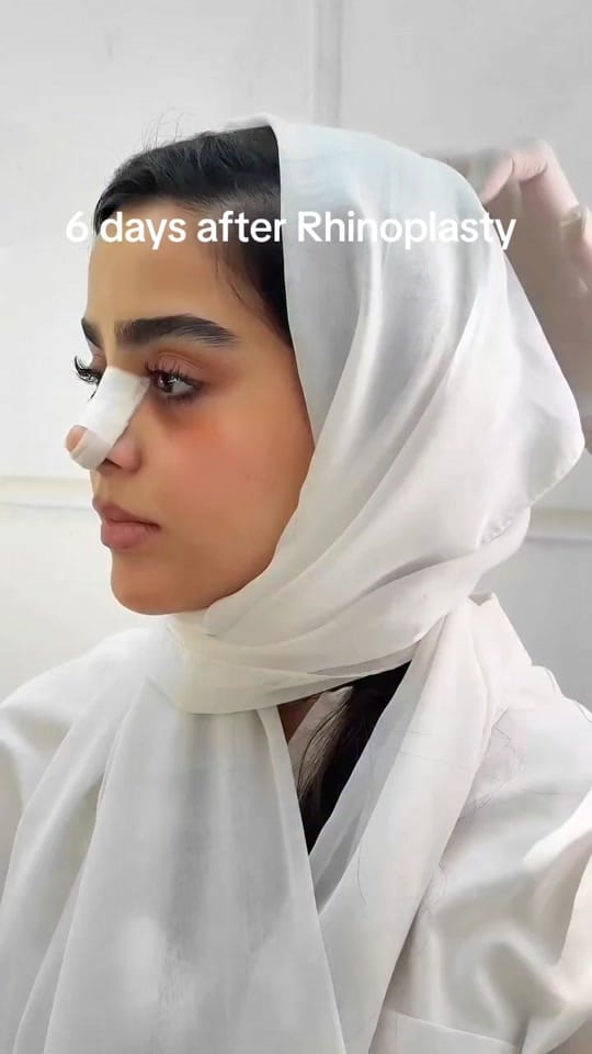 Post 8 by Plastic surgery in Turkey🇹🇷 on TikTok (video)
