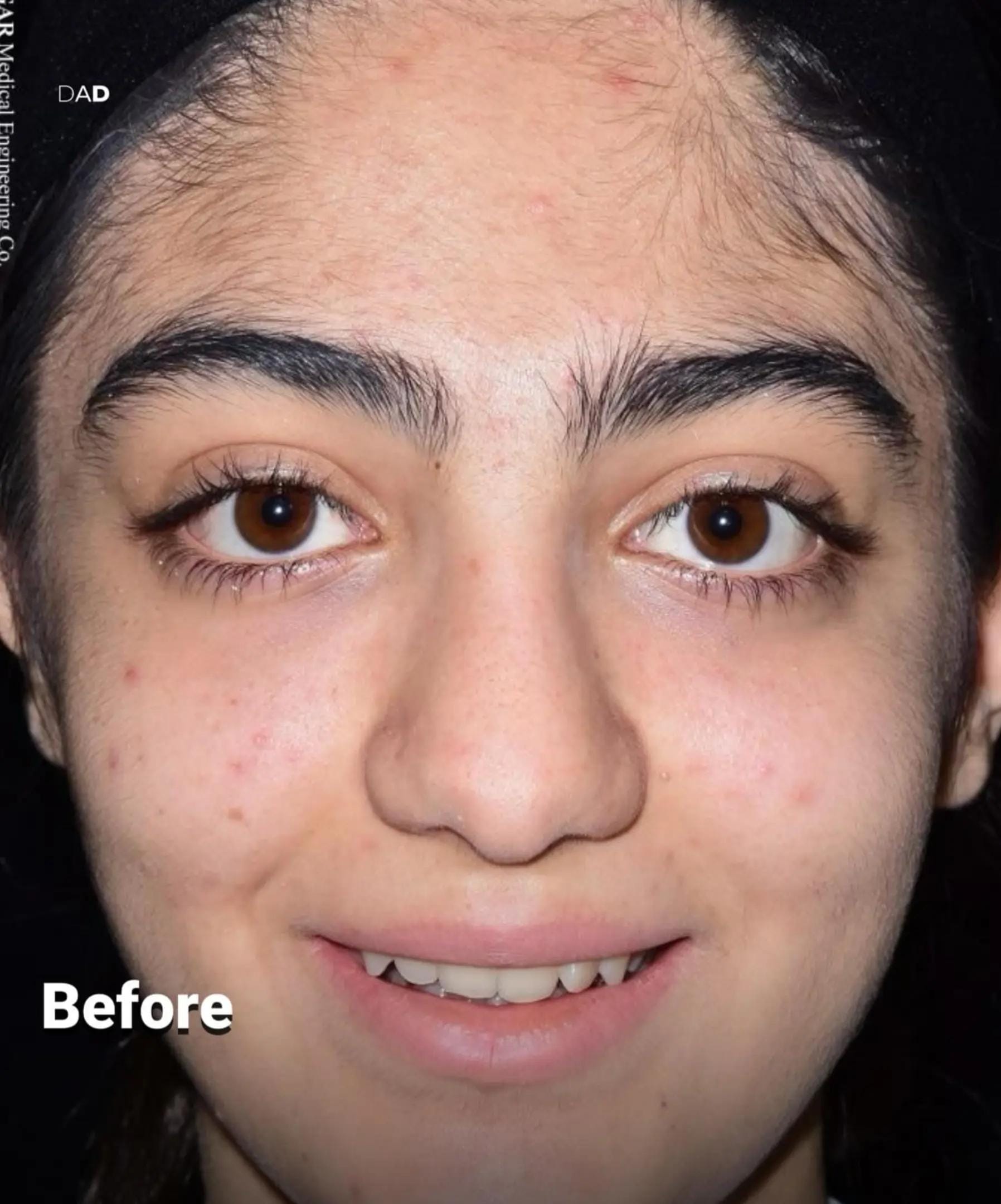Post 7 by Plastic surgery in Turkey🇹🇷 on TikTok (video)