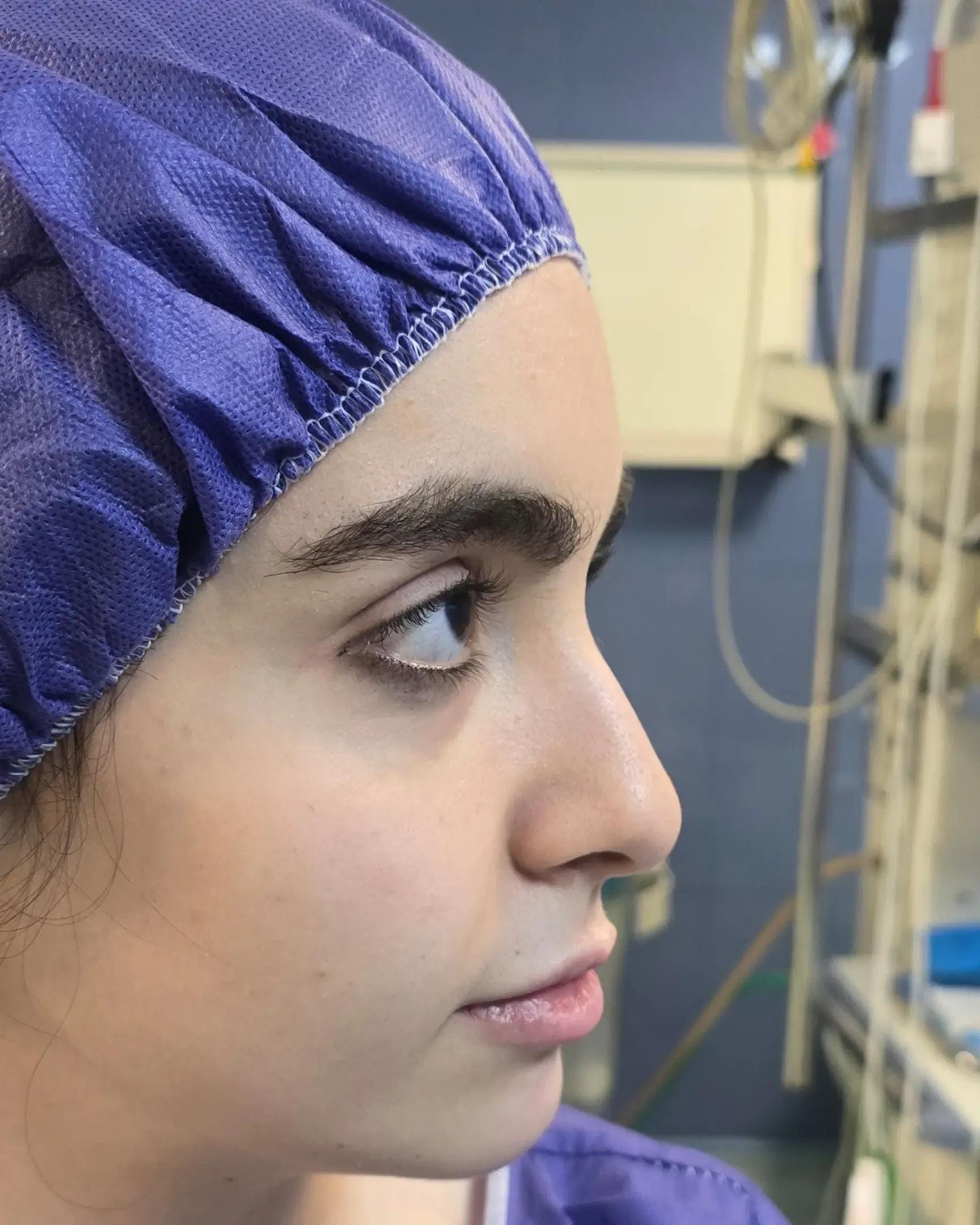Post 2 by Plastic surgery in Turkey🇹🇷 on TikTok (video)