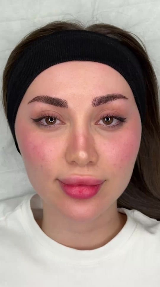 Post 4 by Mehrzad Clinic on TikTok (video)