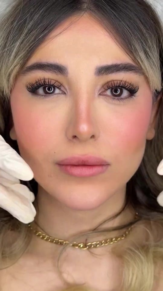 Post 5 by Mehrzad Clinic on TikTok (video)