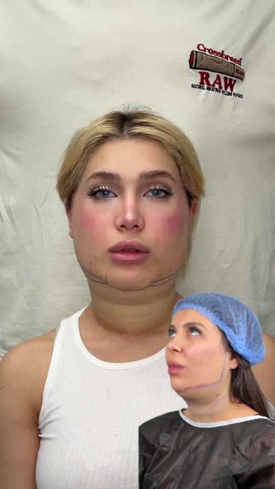 Post 8 by Mehrzad Clinic on TikTok (video)