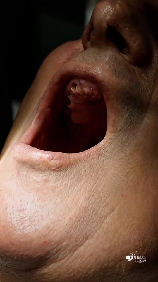 Post 3 by NaturalClinic on TikTok (video)