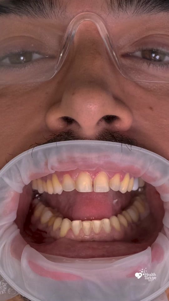 Post 9 by NaturalClinic on TikTok (video)