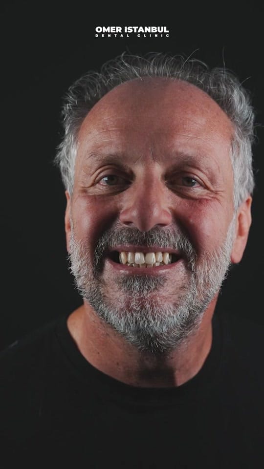 Post 1 by Omer Istanbul Dental Clinic on TikTok (video)