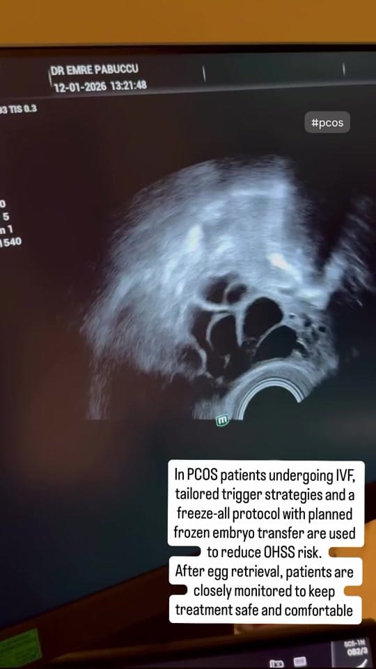 Post 8 by fertilityturkey on TikTok (video)